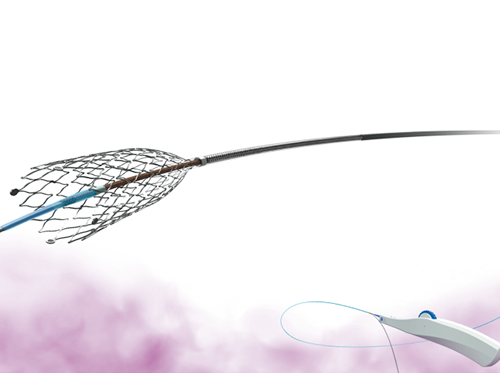 胆管用メタリックステント